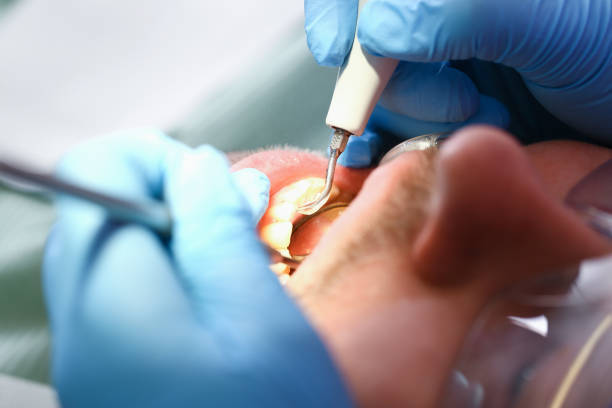 Best Pediatric Emergency Dentist in Cleveland Heights, OH