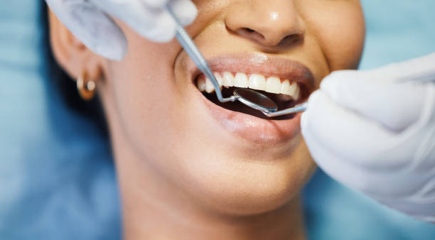 Best Emergency Dentist for Lost Fillings or Crowns in Cleveland Heights, OH
