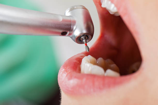 Best Weekend Emergency Dentist in Cleveland Heights, OH